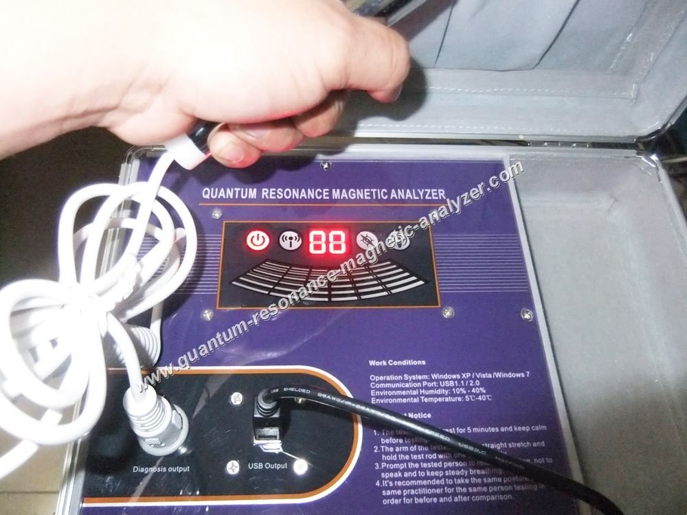 Quantum Resonance Magnetic Analyzer: Revolutionizing Personalized Nutrition 3 Maikong Quantum Resonance Magnetic Analyzer