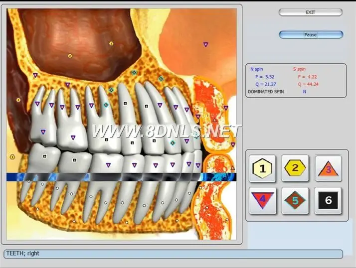 What Is NLS Diagnostic Body Analyzer Quantum Use For