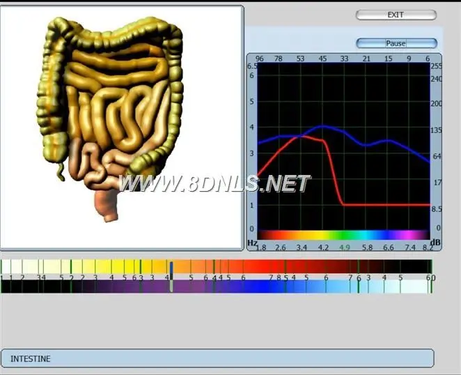 What Is NLS Diagnostic Body Analyzer Quantum Use For