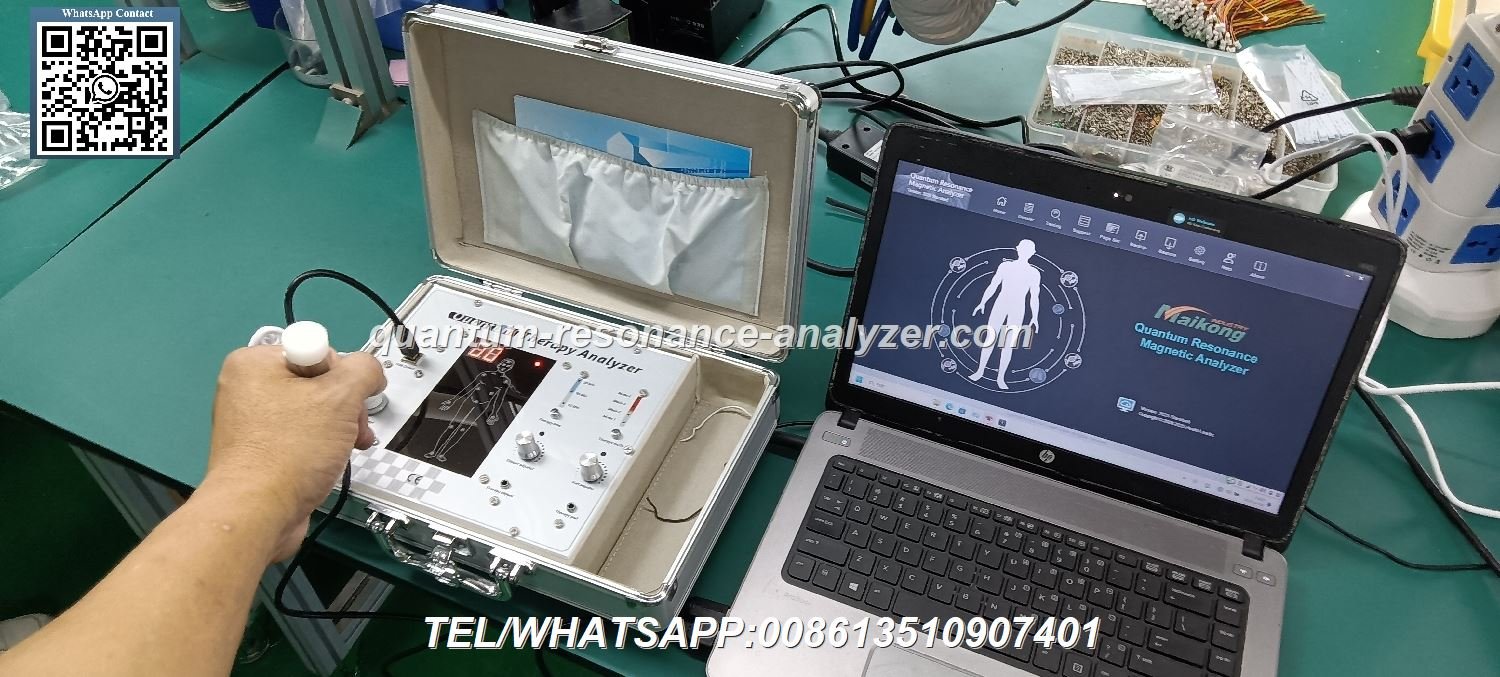 Quantum Resonance Magnetic Analyzer Machine Price
