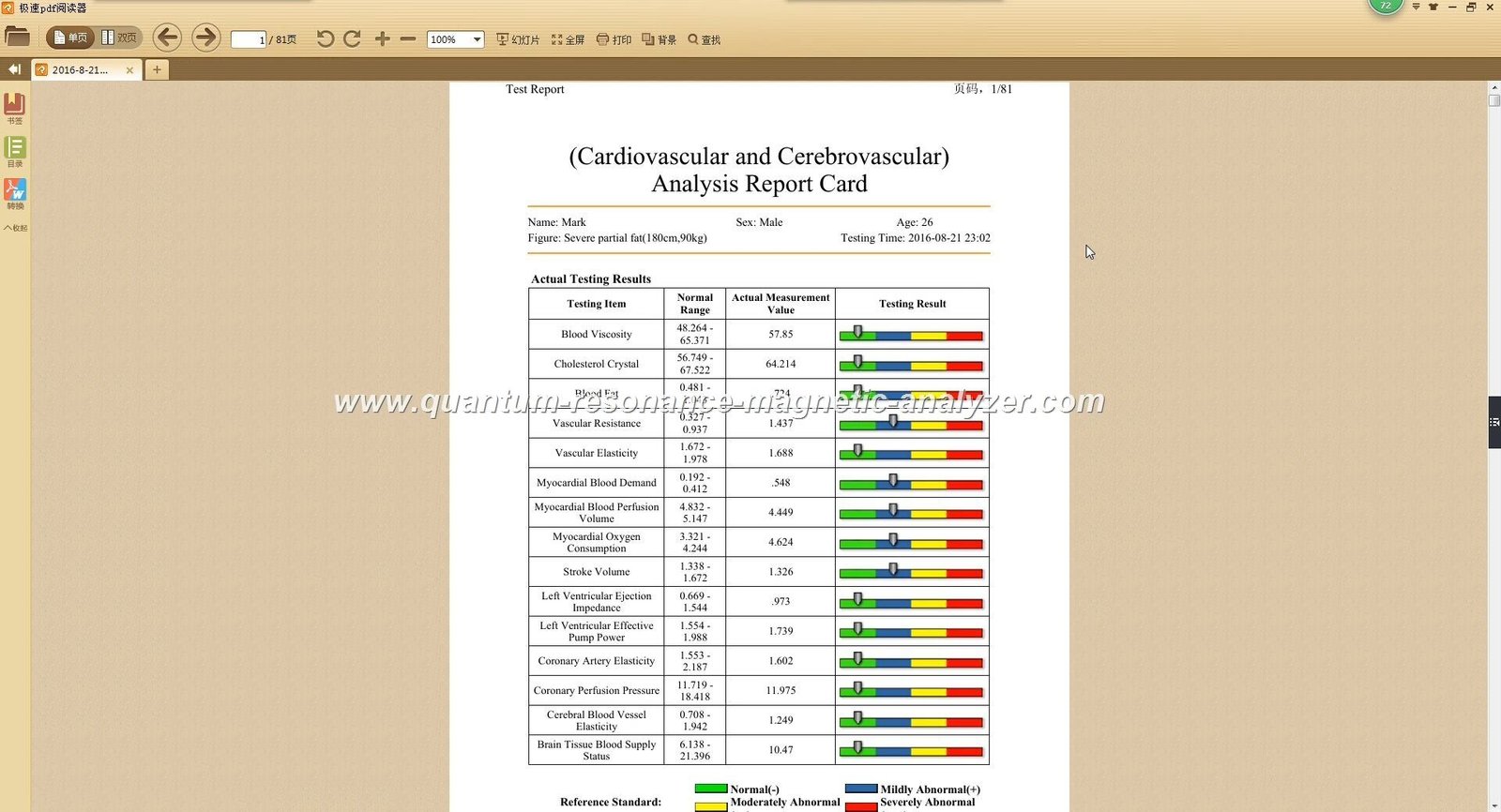 How Reliable Are Quantum Resonance Magnetic Analyzer Test Reports? 13 Quantum Resonance Magnetic Analyzer