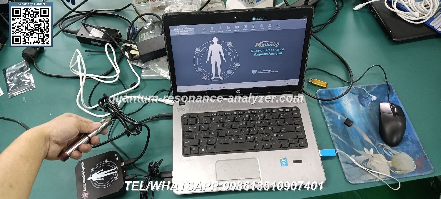 Quantum Resonance Analyzer Device