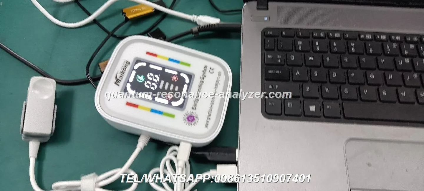 Can a Nigerian Wellness Centre Use a Magnetic Resonance Analyzer? A Practical Guide for Owners — Quantum Resonance Magnetic Analyzer (18).JPG