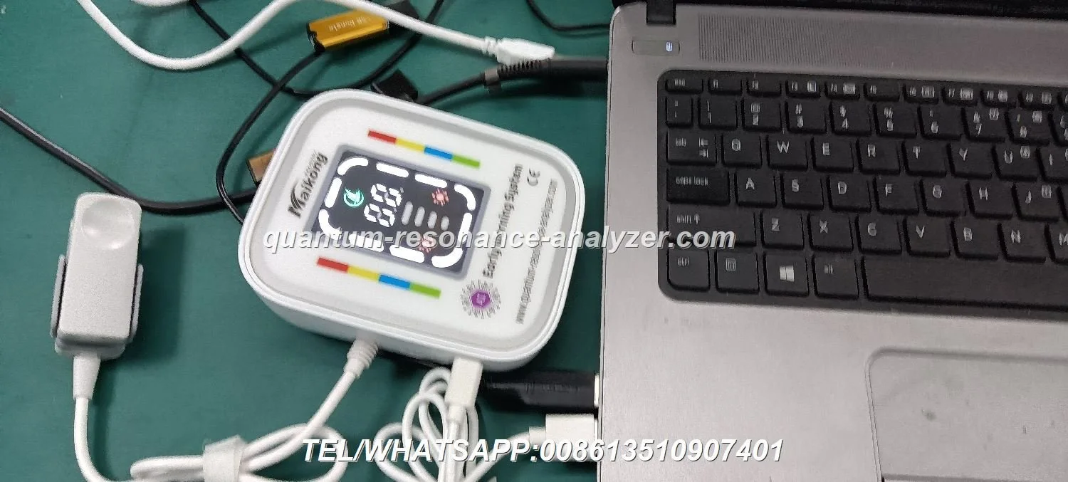 How much does a Quantum Resonance Magnetic Analyzer cost in Nigeria? Price basis, configuration choices and what to include in a quote request — Quantum Resonance Magnetic Analyzer (18).JPG