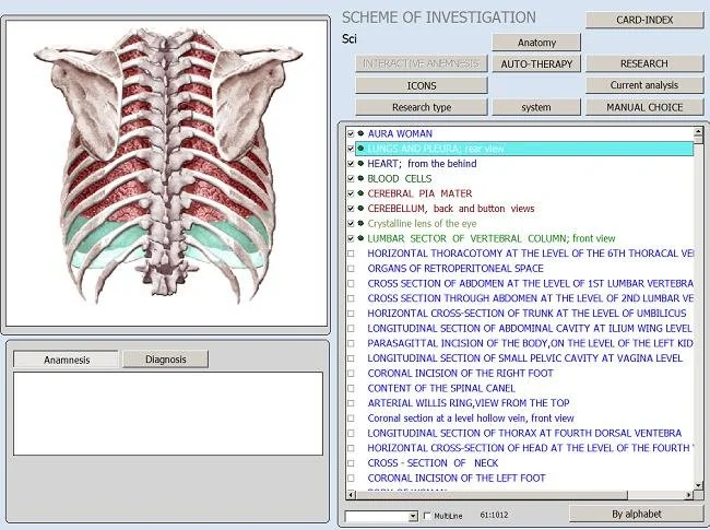 Choosing between 9D NLS and 3D MAIKONG models for your Nigerian clinic — MAIKONG Hunter 4025 Metatron (737).JPG