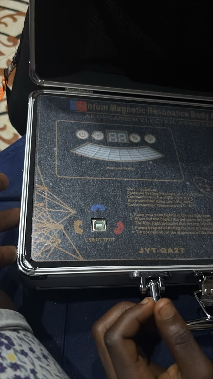 2026-10-3 Problemas de instalación del analizador corporal de resonancia magnética cuántica 1 instalación analizador resonancia magnética cuántica