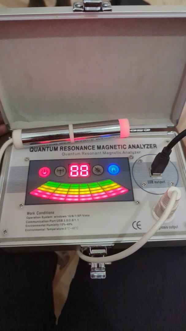 2026-10-5 Passwort für Scannermaschine-Software verloren 1 Scannermaschine Software Passwort